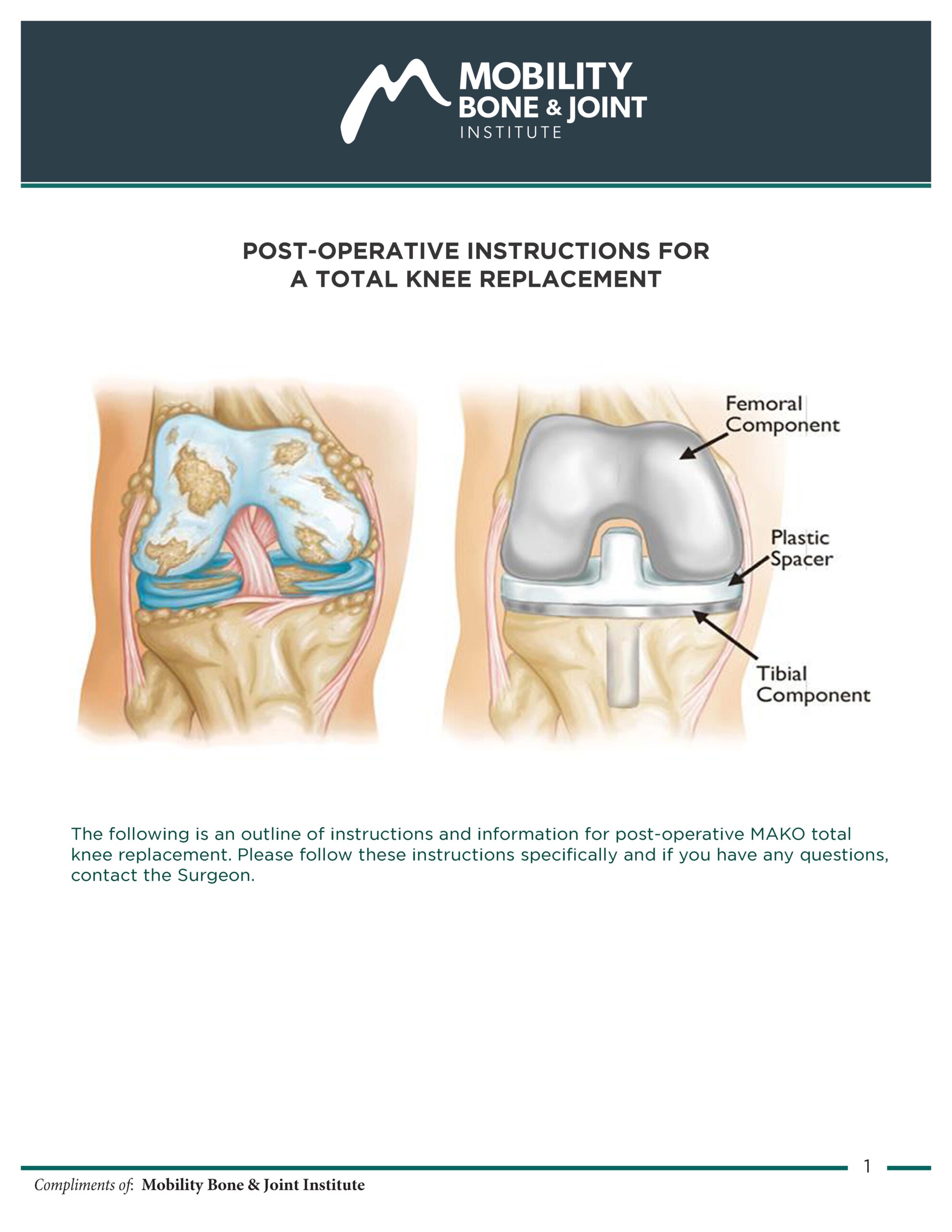 POST-OPERATIVE INSTRUCTIONS FOR A TOTAL KNEE REPLACEMENT